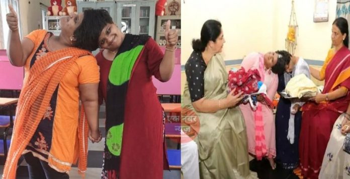 twins Veena and Vani